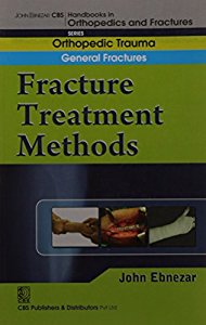 Fracture Treatment Methods (Handbook In Orthopedics And Fractures Vol ...